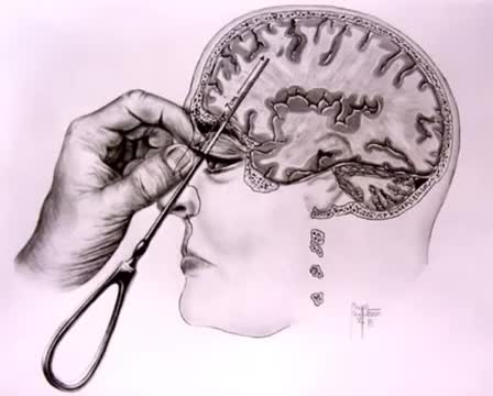 utomp3.com---lobotomy-sound-effect.mp4