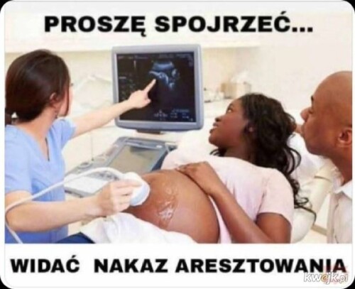 UpUz0.jpg