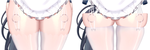 kKJa2.png