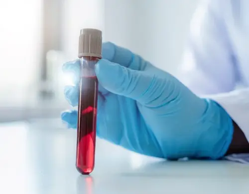 leucemia